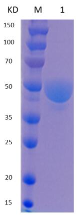 12% SDS-PAGE analysis profiles of purified MCR_RS06410-25-365 (CBB stained).
